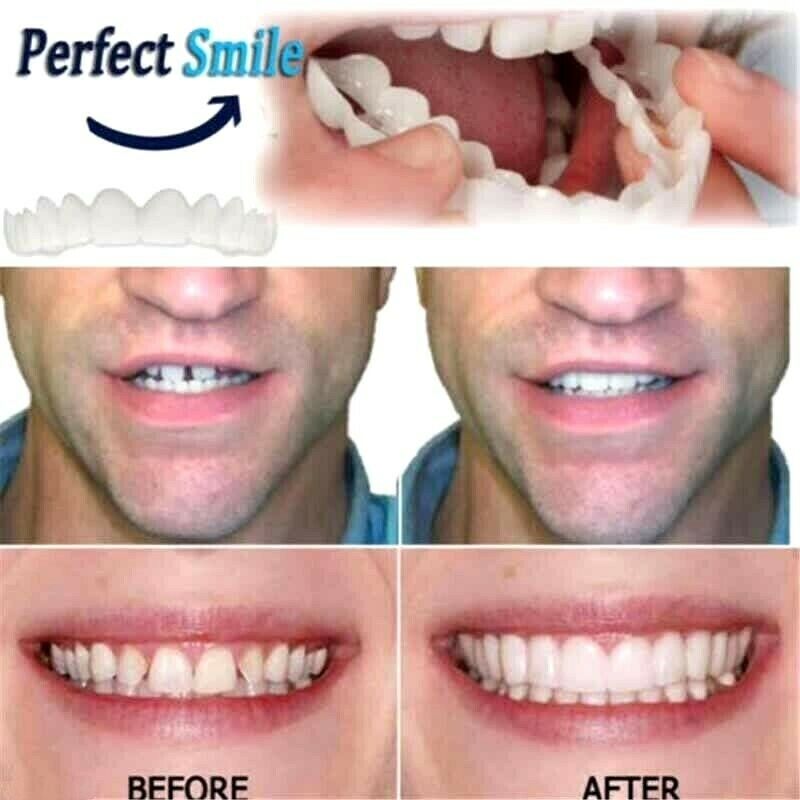 Magic Teeth Brace Temporary Smile Comfort Fit Cosmetic Denture Teeth Dent