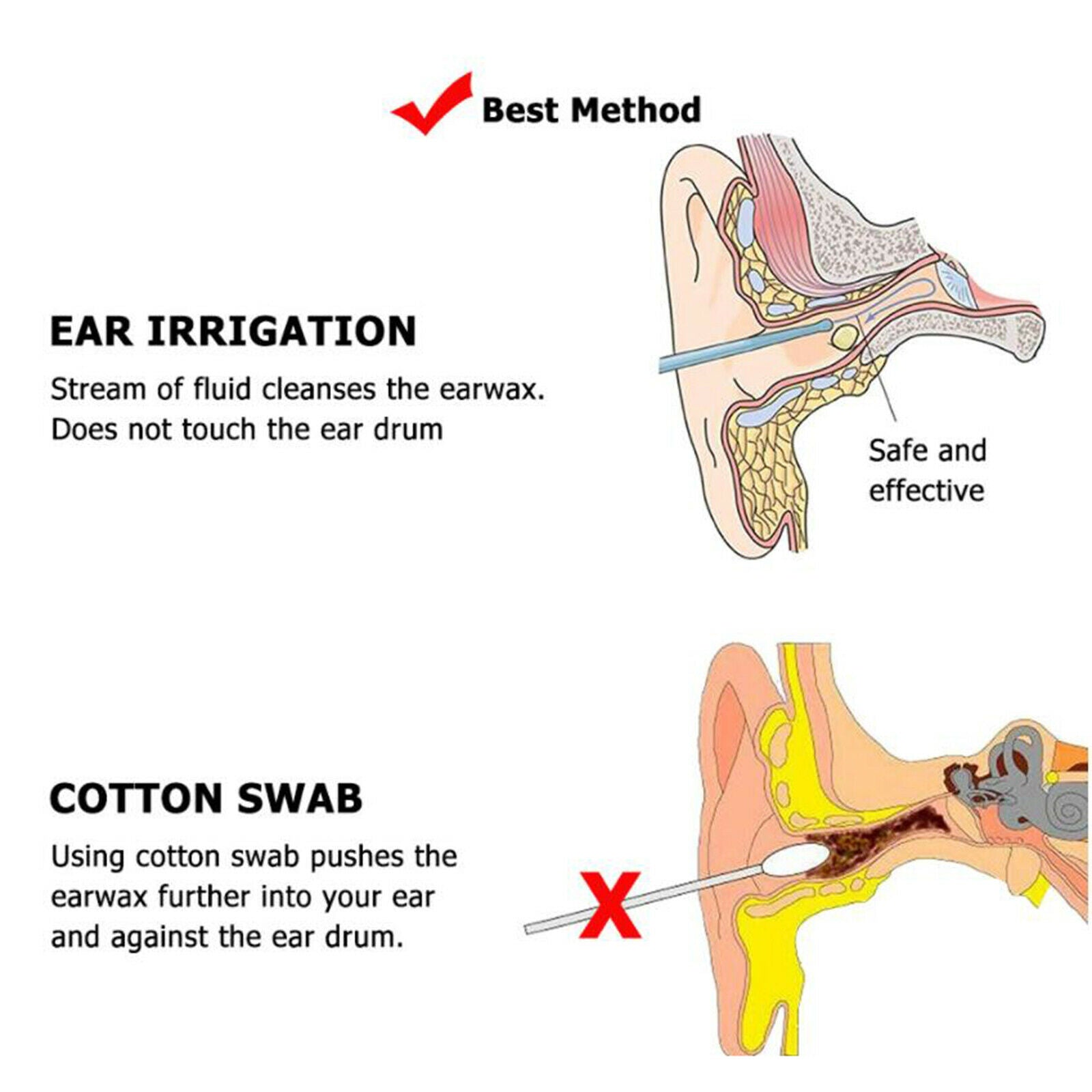Earwax Removal Set Ear Washer Bottle Cleaning System All Inclusive Kit