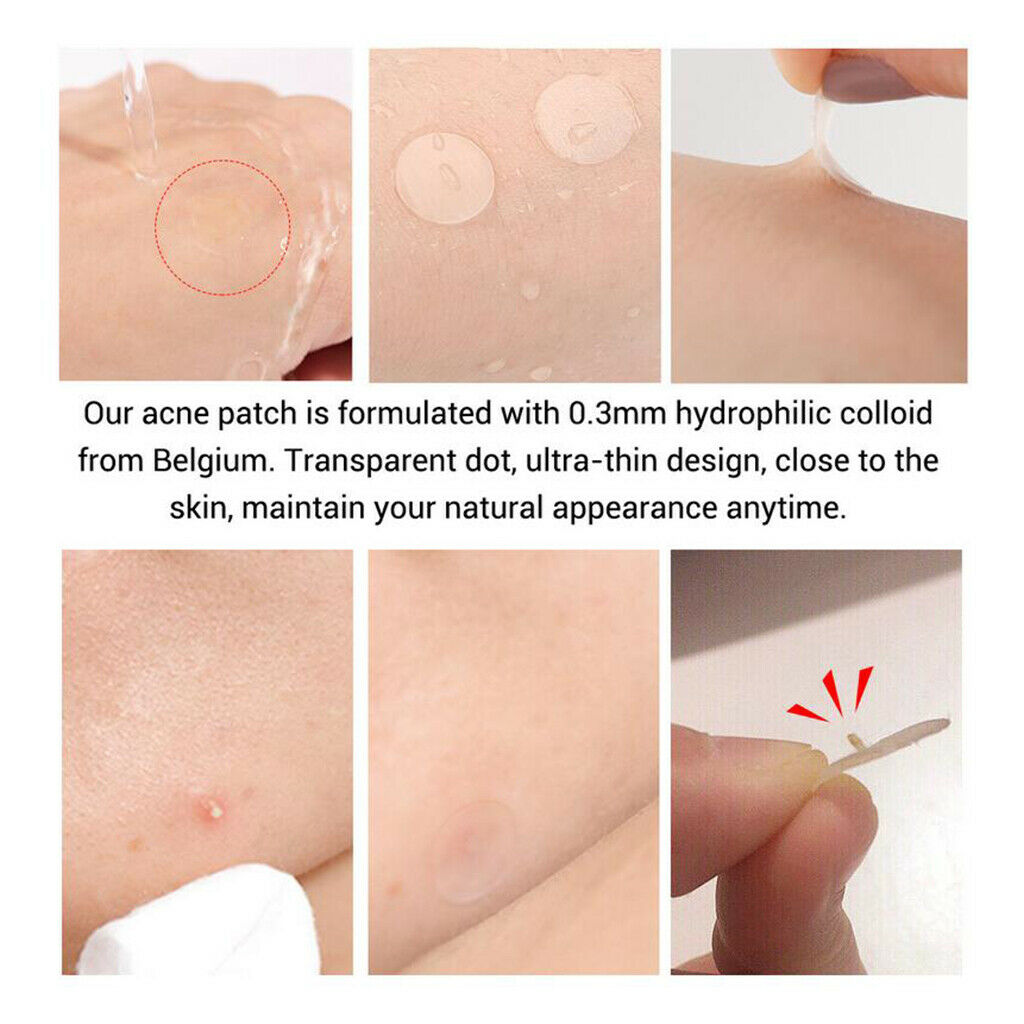 53 Pieces Hydrocolloid Acne Stickers Transparent Facial Spot Face Skin Care