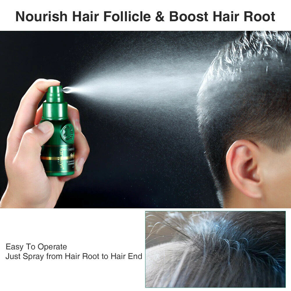 Ginger Hair Growth Essential Spray Anti Hair Loss Serum 7 Days Effective 30ml