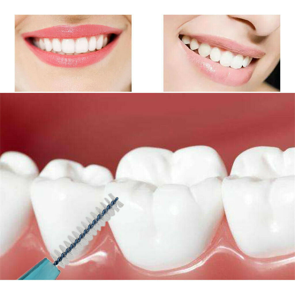 10x Interdental Brush Cleaner  Brush Between Teeth Removes Food Debris
