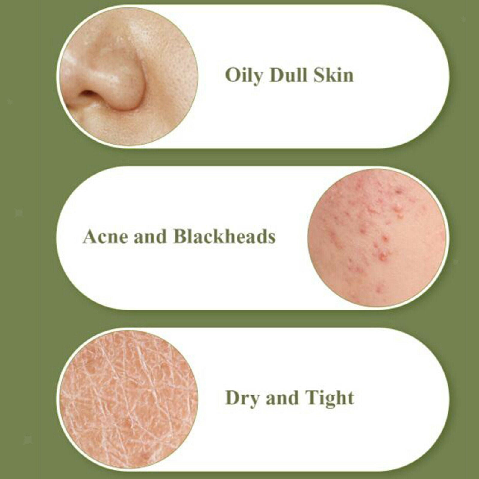 80g Tea Tree Soap Face Body Acne Removal Bath Skin Care Oil Control Deep Clean