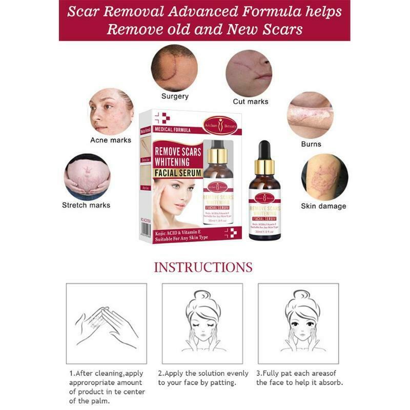 Scar Removal Whitetening Face Serum Scars Treatment Skin Repair for Face Acne