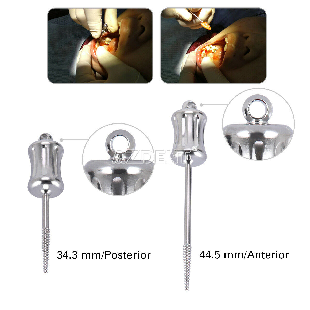 2Pc Dental Extractor Rotate Apical Root Fragments Drill Long+Short 34.3mm-44.5mm
