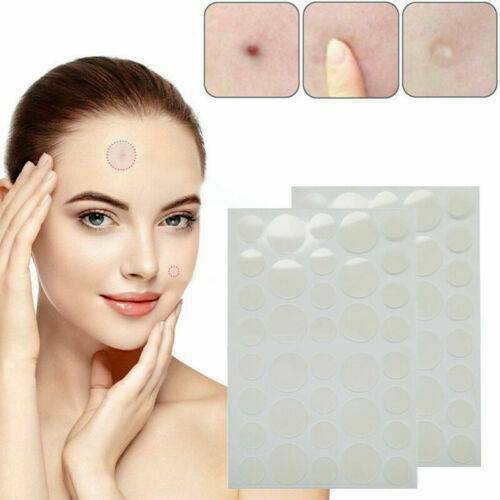 Skin Tag & Acne Patch - Hydrocolloid Acne and Skin Tag Remover Patches - 36 Pcs