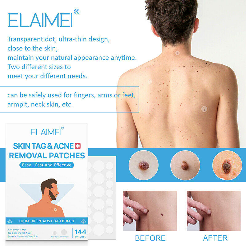 144PCS Skin Tag Acne Patch Hydrocolloid Acne Skin Tag Invisible Remover Patc SJ