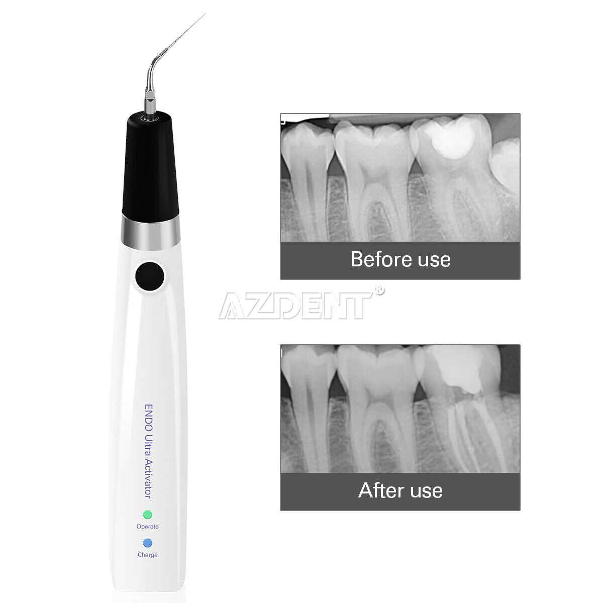 Dental Ultrasonic Sonic Endo Irrigator Endo activator kit + Endo Motor Treatment