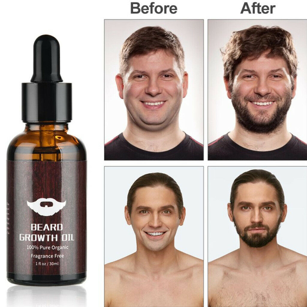Beard Growth Kit Titanium  Roller for Men roller Hair Growth -