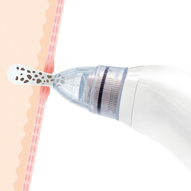 Shop-Story - Pore Off: Vacuum Cleaner Points Black To Heads Interchangeable