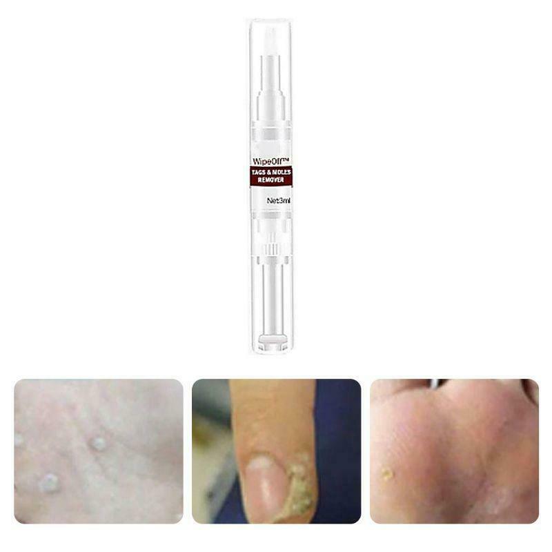10ml Skin Tags Moles Remover Pen Facial Body Wart Dark Spot Treatment Liquid
