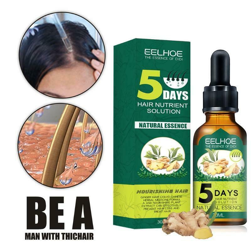 30ml Unisex Natural Ginger Extract Hair Growth Spray Care Essence Nourishing