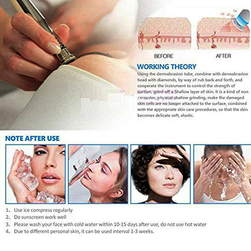 Dermabrasion Accessory Tip Diamond Microdermabrasion Replacement Skin BeautyBDD