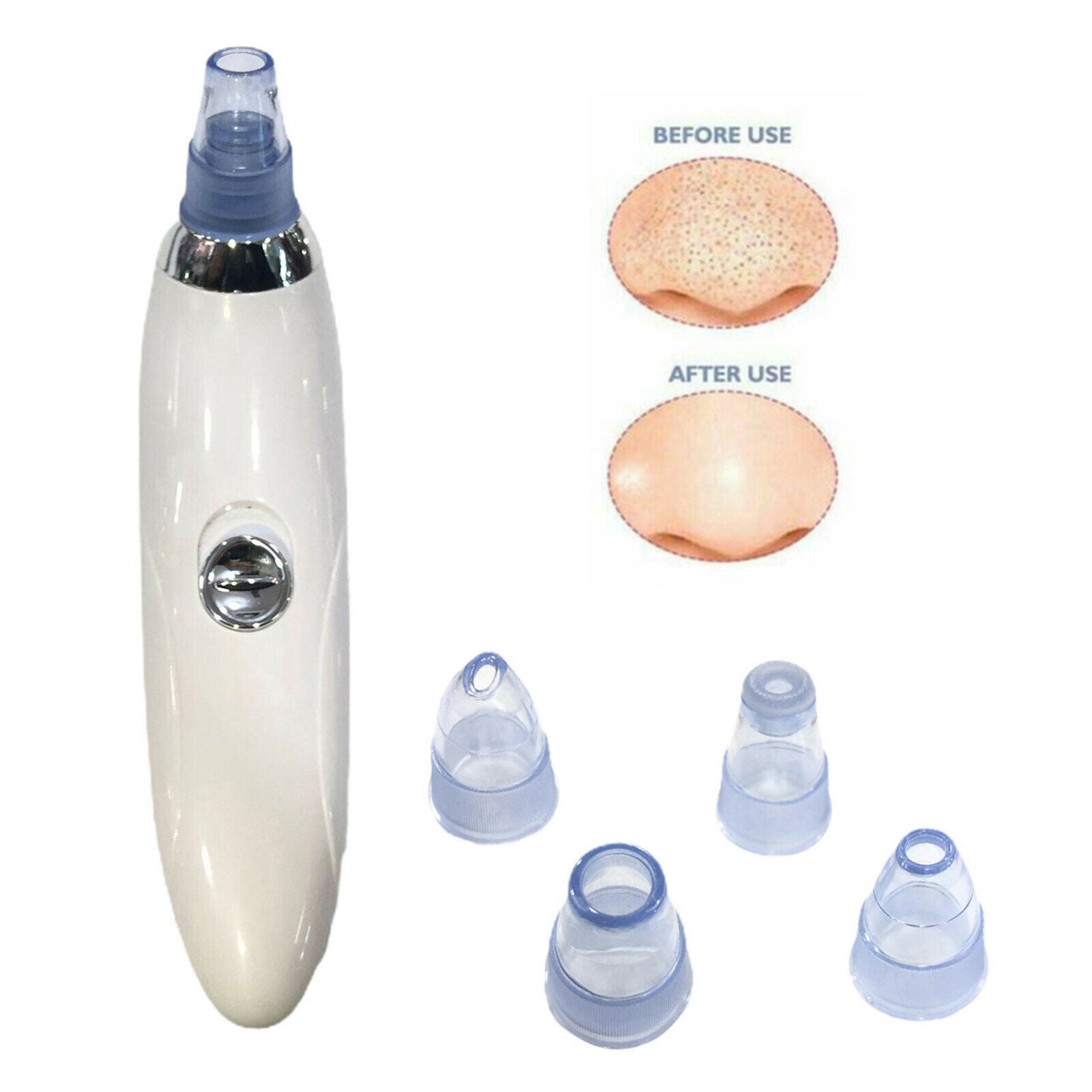 Blackhead Remover Vacuum Electric Facial Pore Cleaner Acne Comedone Extractor
