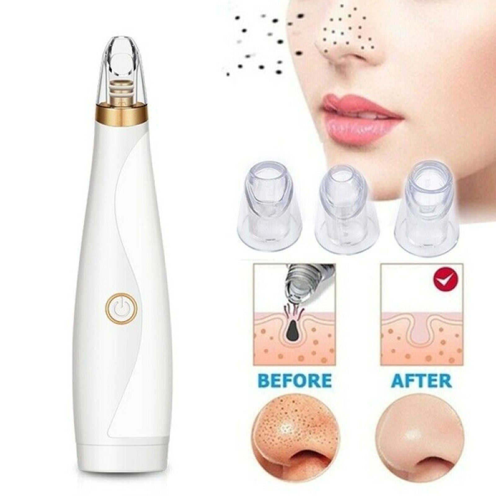 1pc Electric Pore Cleaner Vacuum Blackhead Remover Face Pore Suction Cleaner