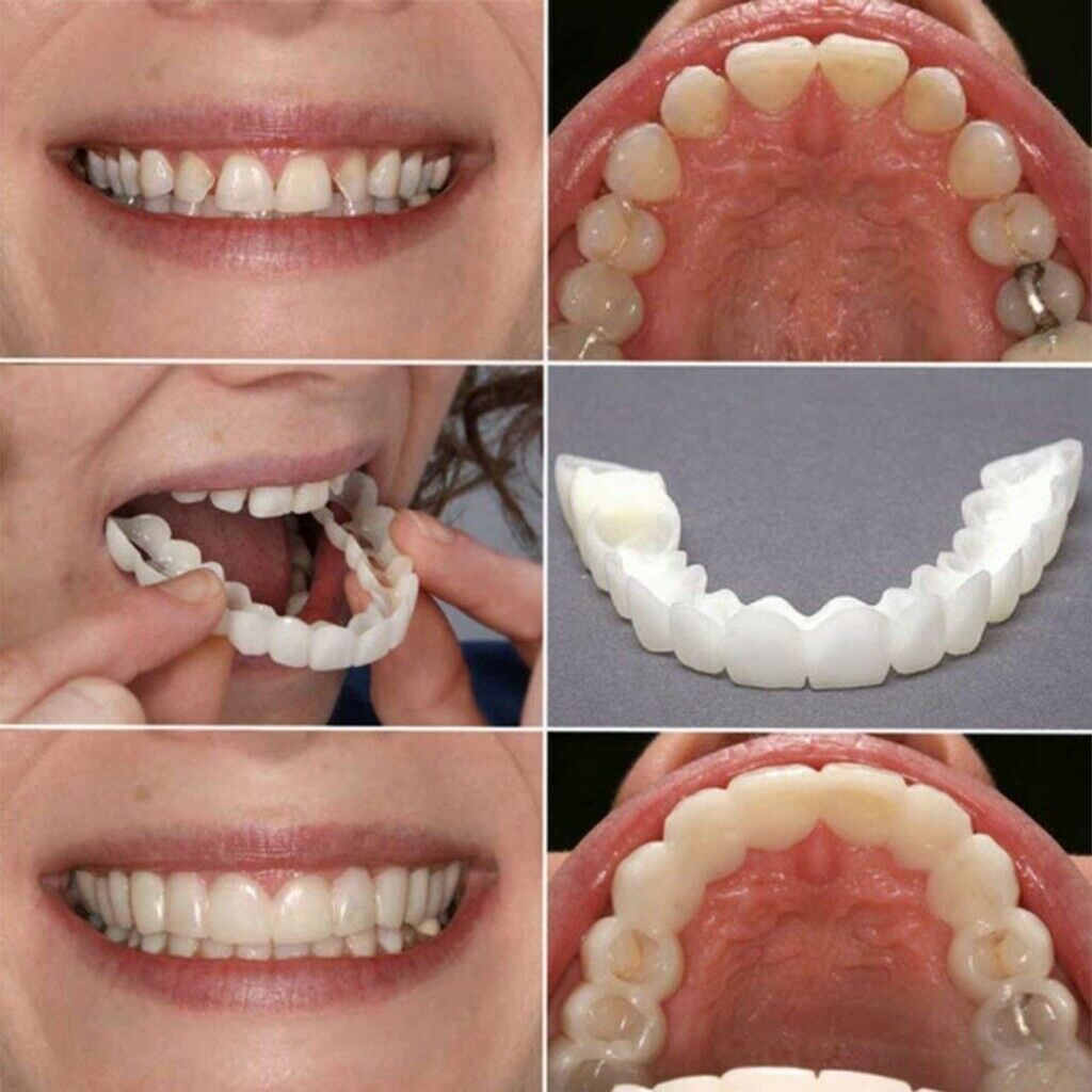 1Pc Soft  Flex Top Upper Cosmetic Teeth Cover Veneers Instant Smile