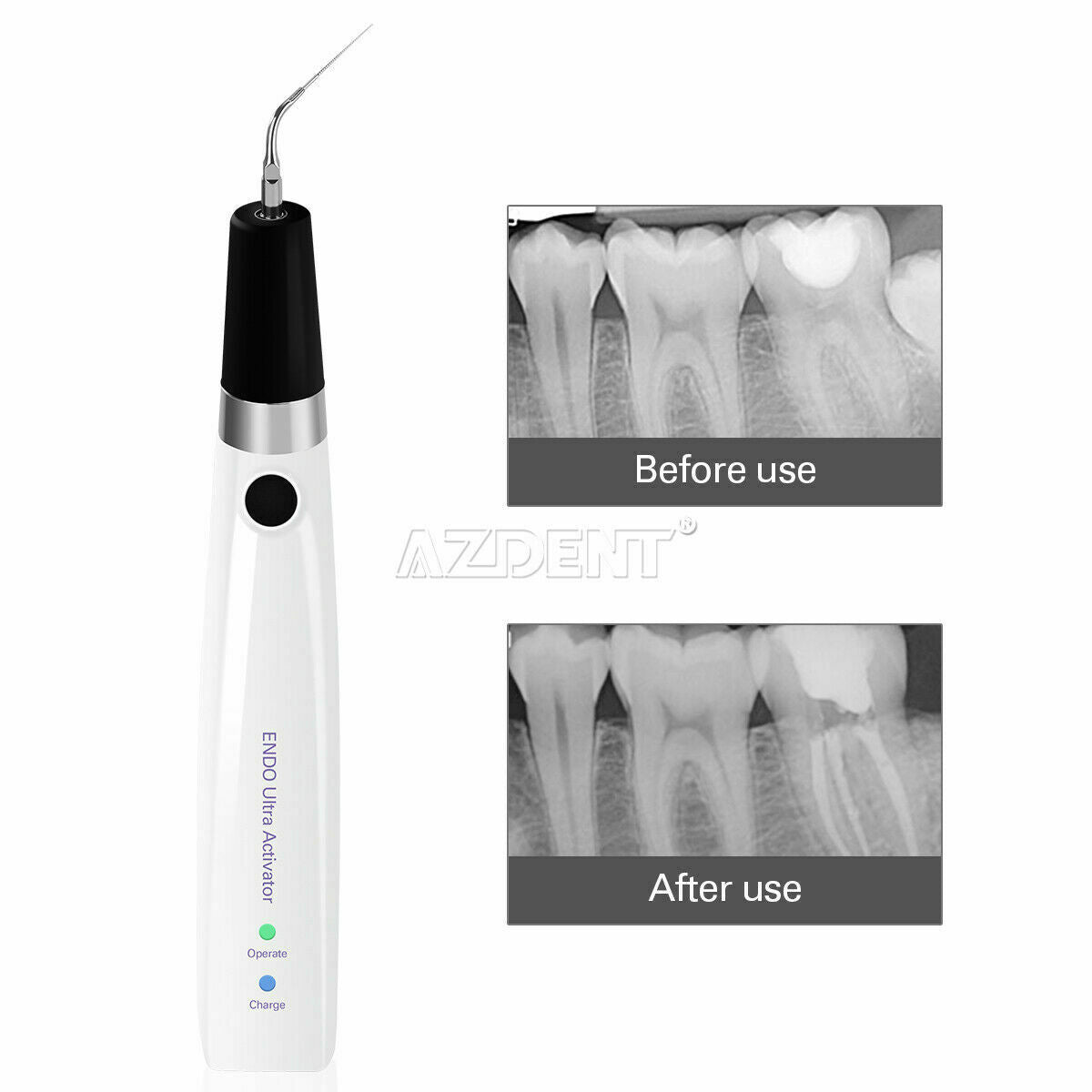 Dental Endo Ultra Activator Handpiece Sonic Endo Irrigator + 6pcs Titanium Tips