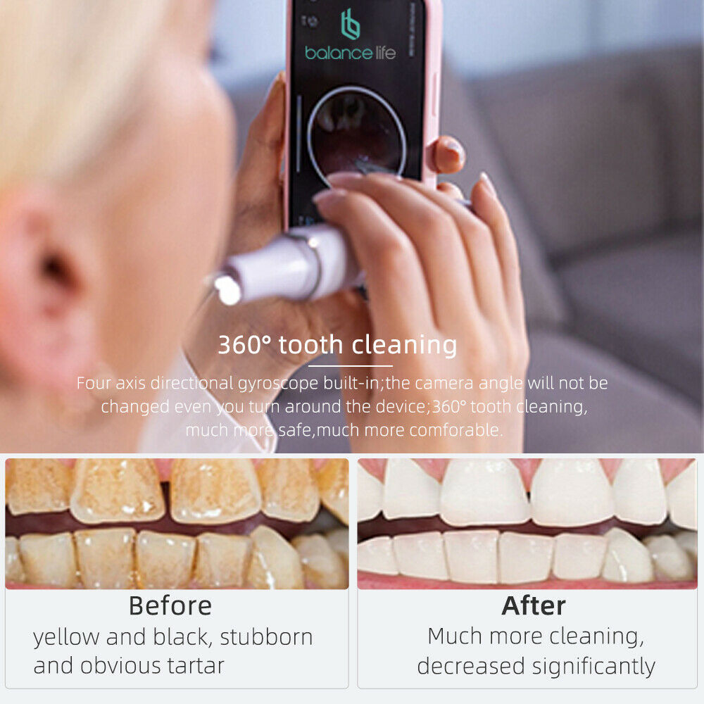 Electric Tartar Remover Tartar Ultrasonic Whitening Dental Calculus Remover LIN
