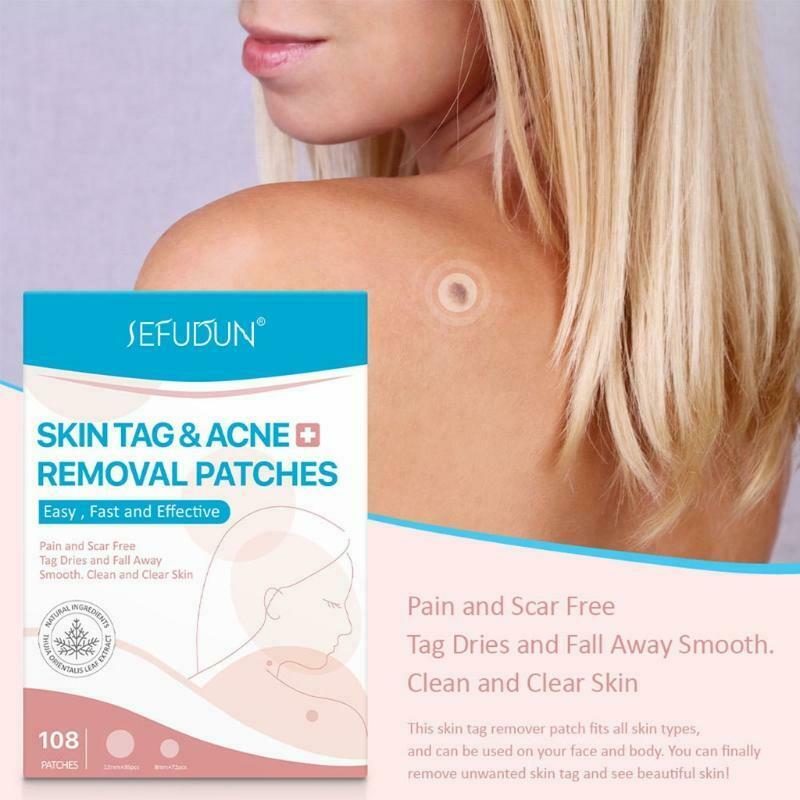 108 Patches Skin Tag Remover Patch Wart Removal Stickers Cover Conceals Tags