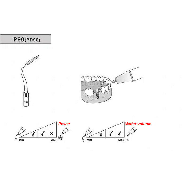 Dental Ultrasonic Scaler P90 Tip Implant Cleaning Periodontal for EMS WOODPECKER