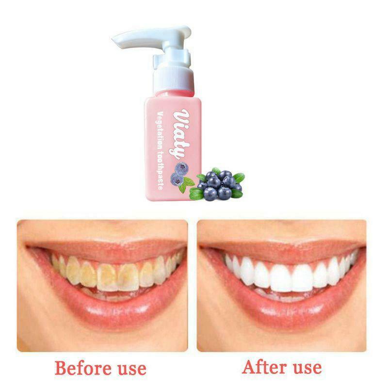 Viaty Vegetation Toothpaste Stain Smoke Removal Reduce Tooth Dirt Whitening Toot
