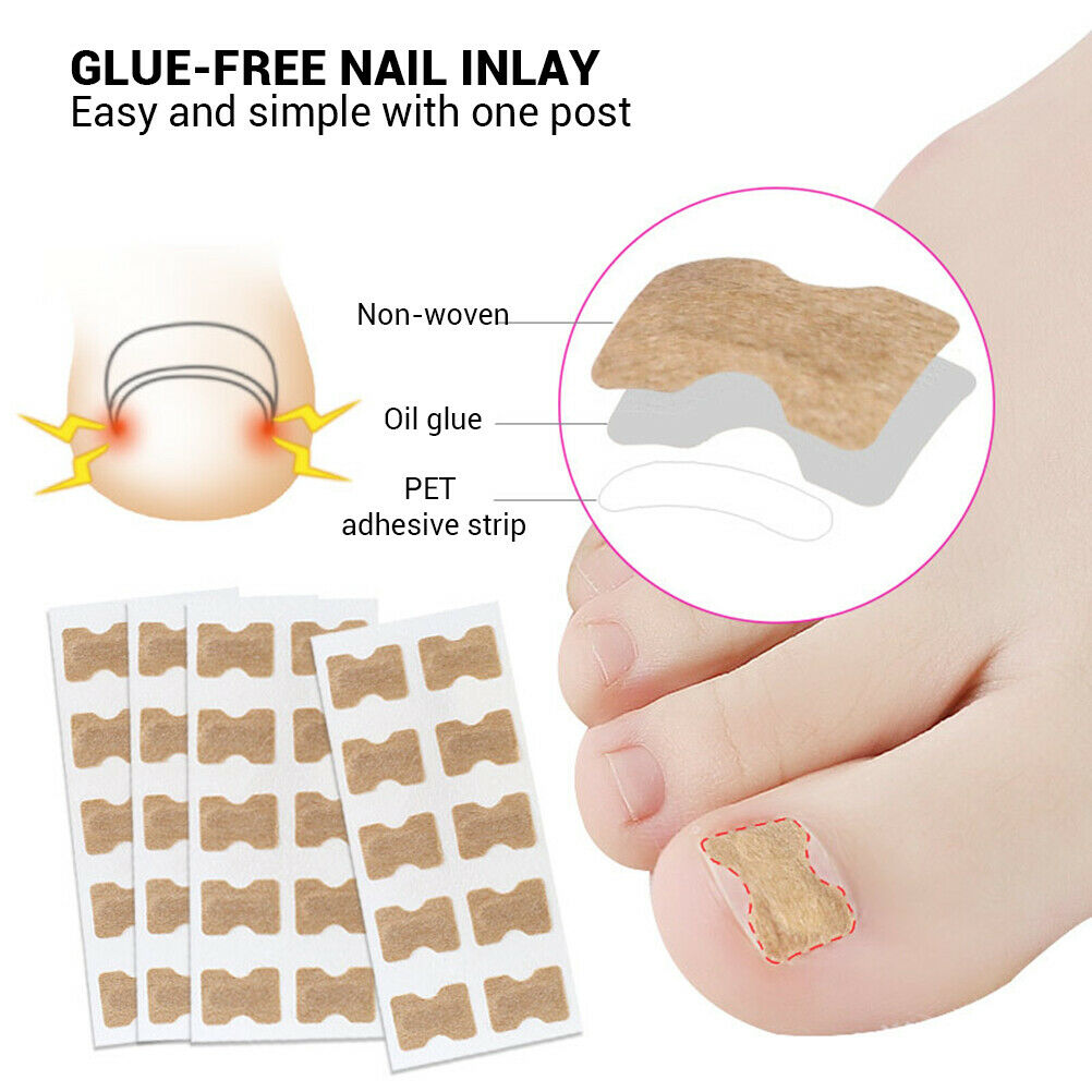 50x Ingrown Toenail Corrector Stickers Double Sided Tape Corrector Pedicure Tool