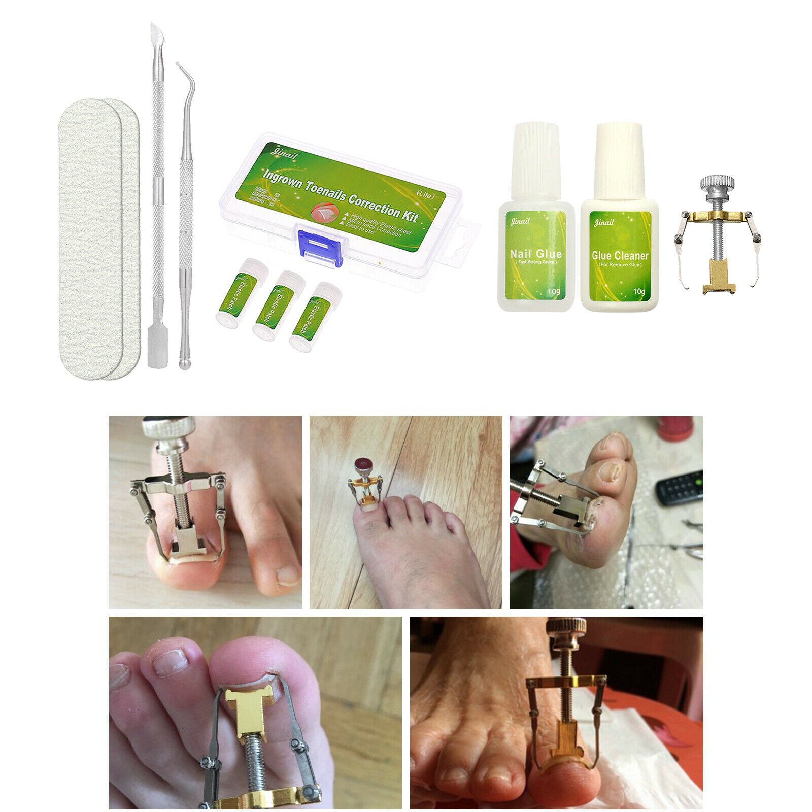 Foot Care Elastic Pedicure Patch with GlueIngrown Nail Straightening