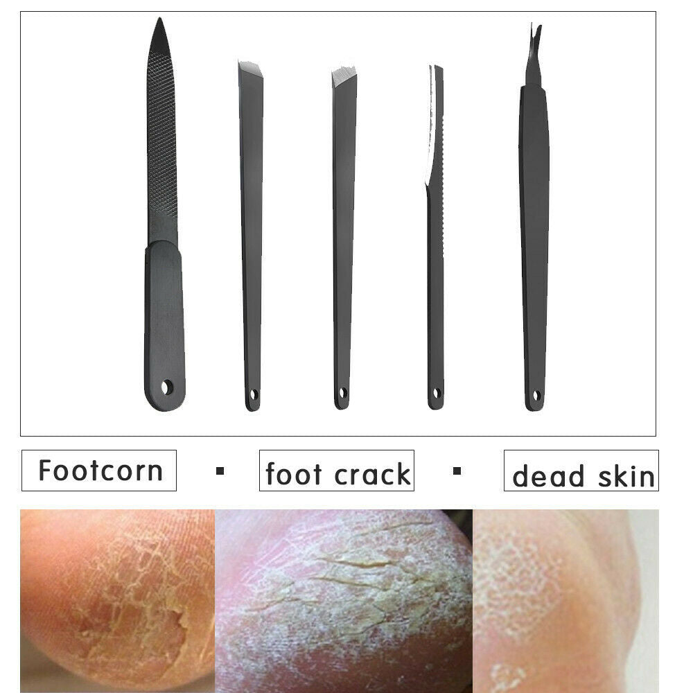 5 Pcs Professional Pedicure Kit Rasp Foot File Callus Remover Nail Care Tool US!