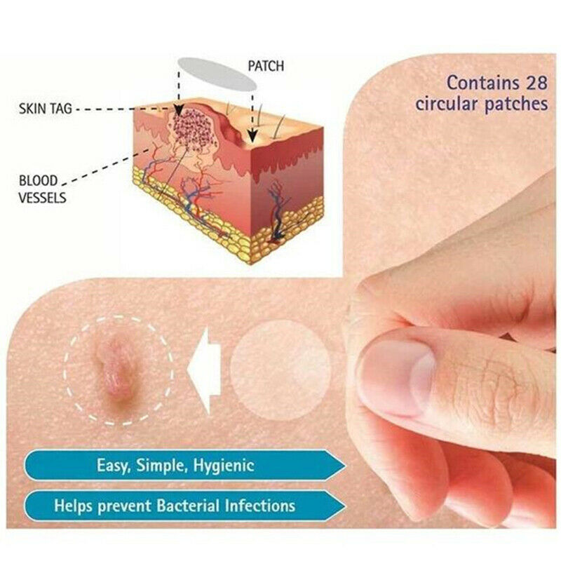 Skin Tag Remover Patch Ance Pimple Patch Anti-infection Quick Absorb Face.l8