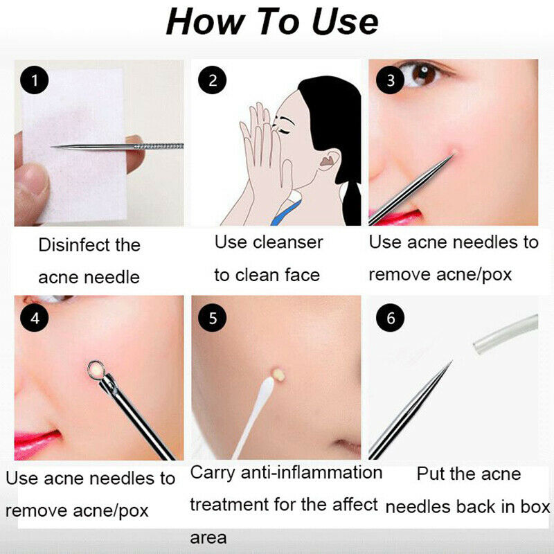 4pcs Stainless Steel Acne Removal Needles Pimple Blackhead Remover Tools Spoonï¼