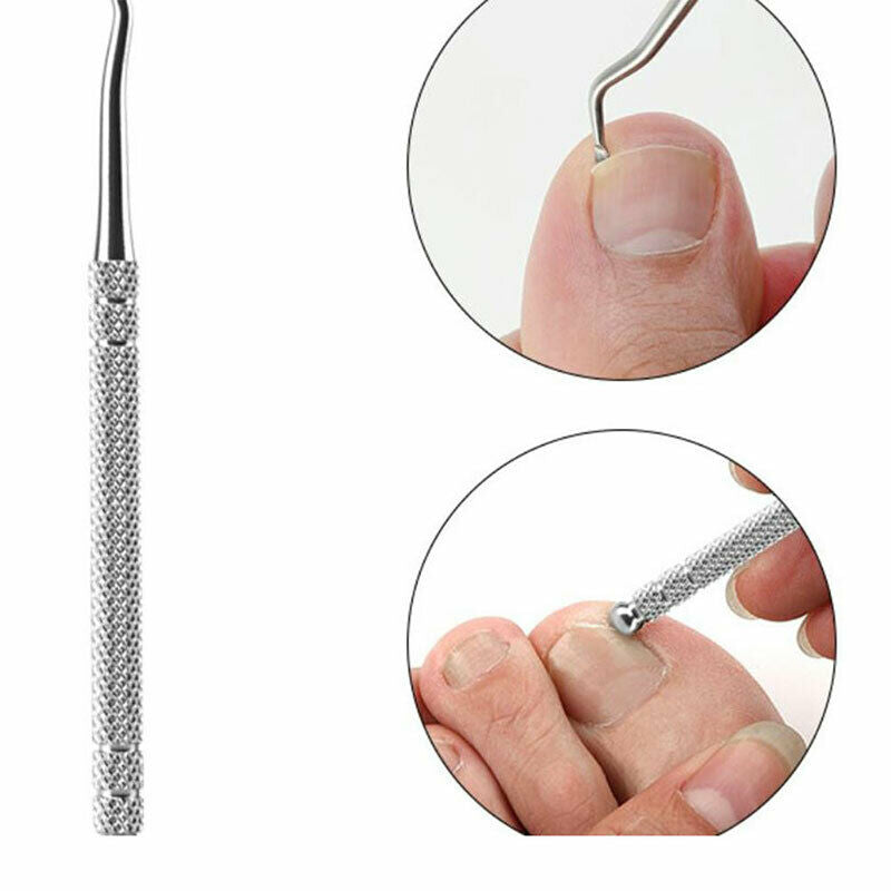 New Ingrown Toe Na Fixer Pedicure Recover Embed Toenail Correction Lifter USSJC