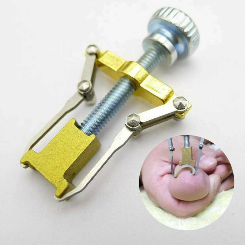 Ingrown Toe foot Nail Correction Fixer Nail Pedicure Tool Toenail Corrector US