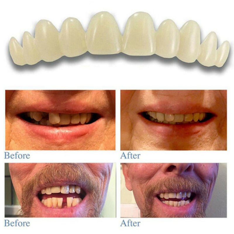 3pcs Reusable Teeth Veneers with Thermal Fitting Beads Temporary Teeth White