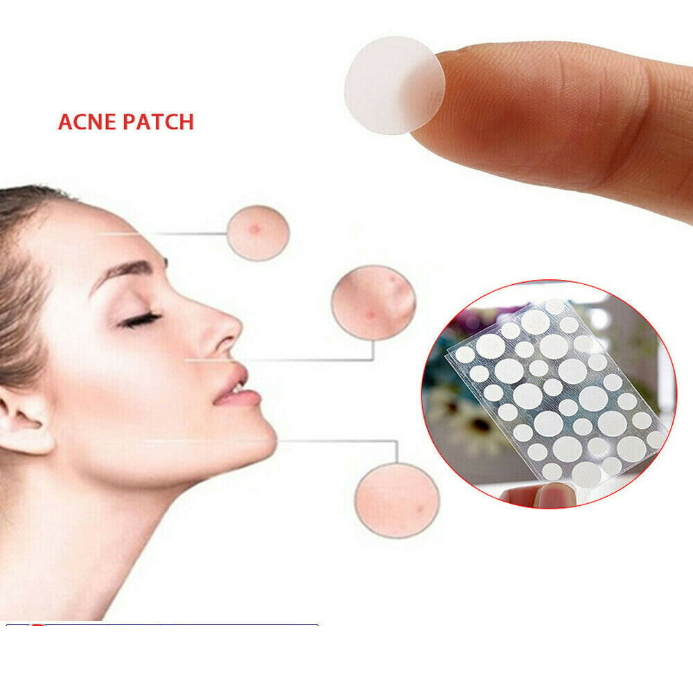 36 Patches Anti Acne Pimple Patch Face Skin Spot Scar Care Treatment Stickers ..