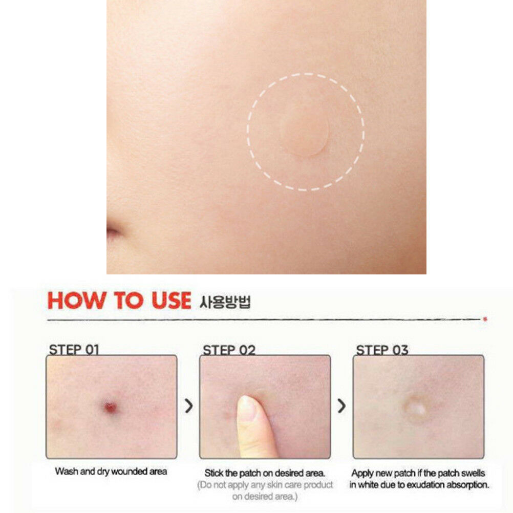 15Pcs iInvisible acne pimple master patches face scar care treatment stick.l8