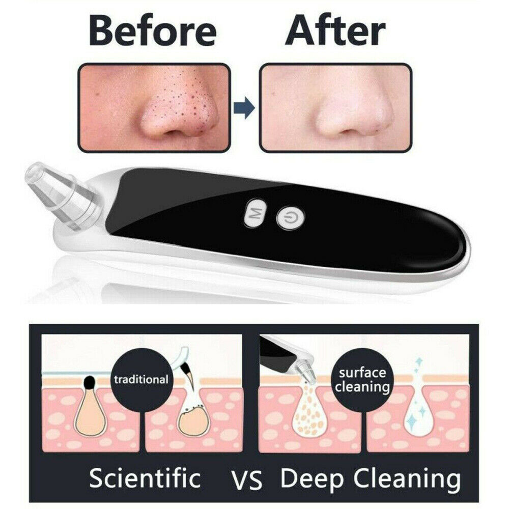 Electric Blackhead Remover Vacuum Suction Facial Acne Pore Cleaner Tool