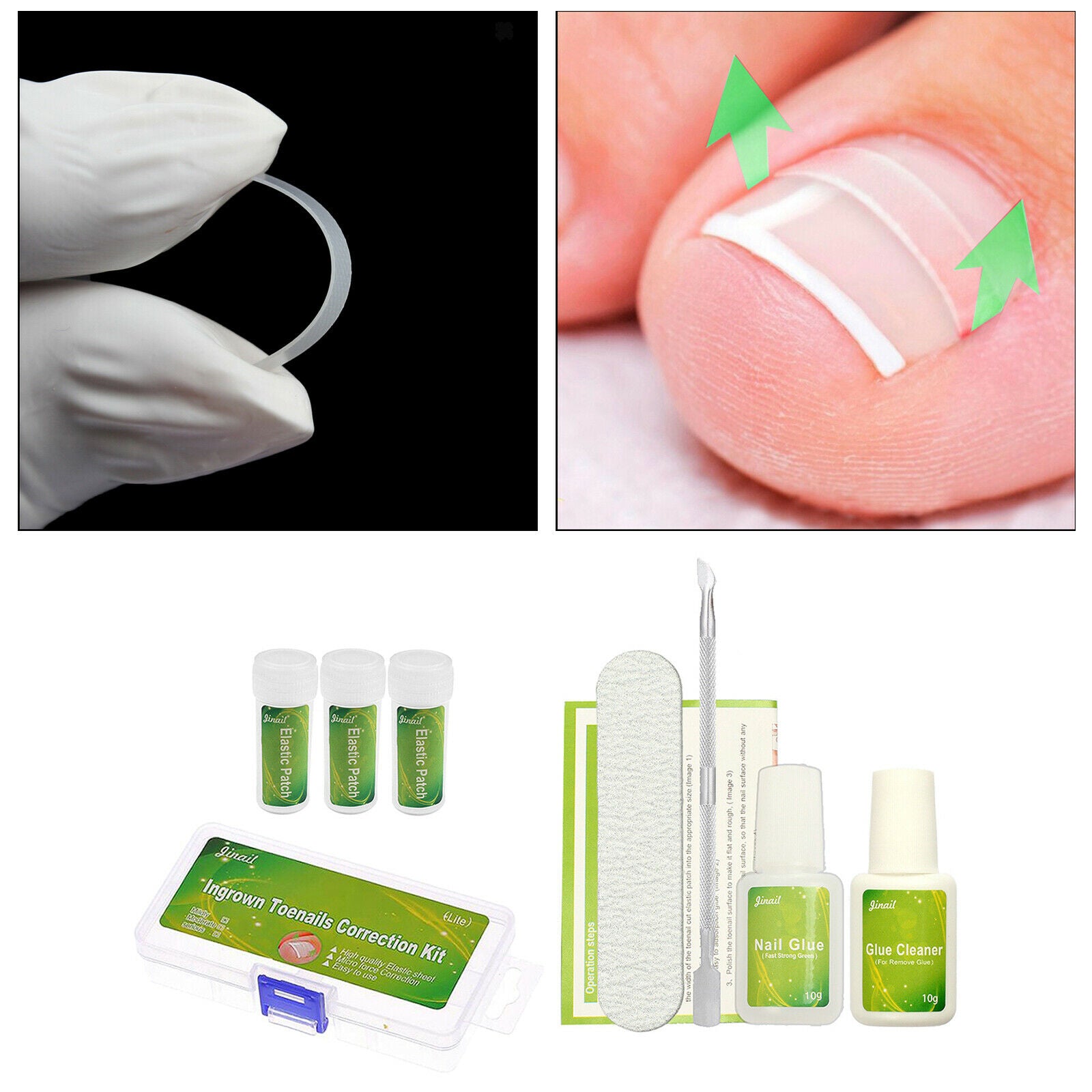 Ingrown Toenail Correction Tool Set Toenail Straightening Foot Nail Treament w/