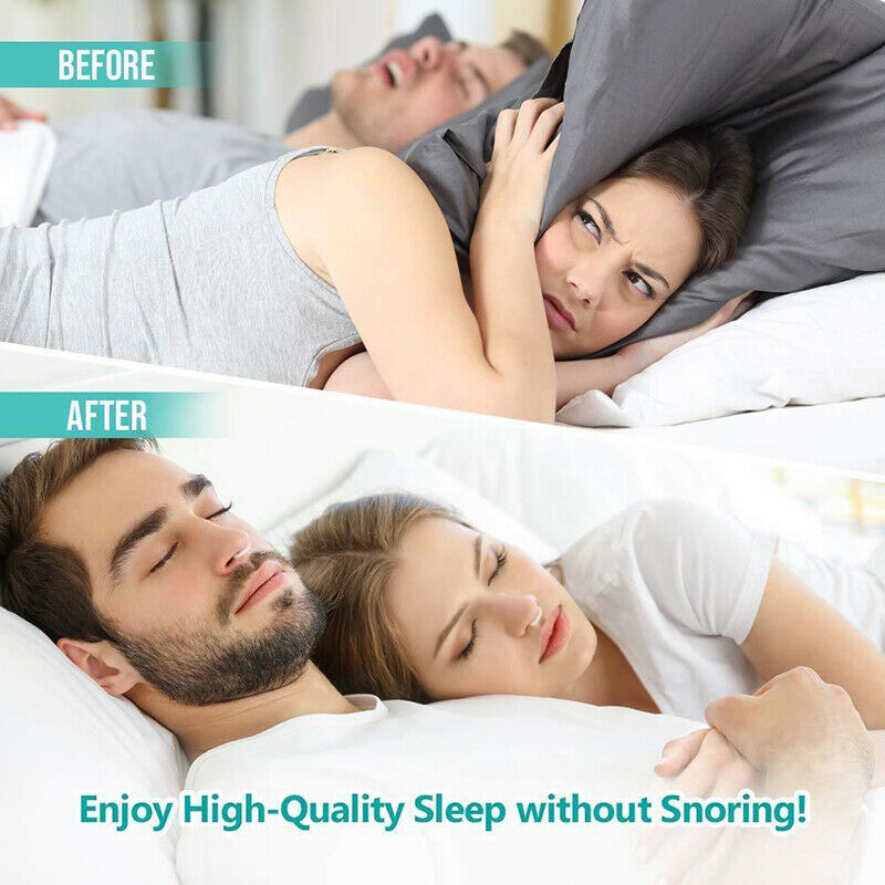 Anti Snoring Acusnore Snore Free Magnetic Nose Clip Case Apnea Sleep Aid .l8