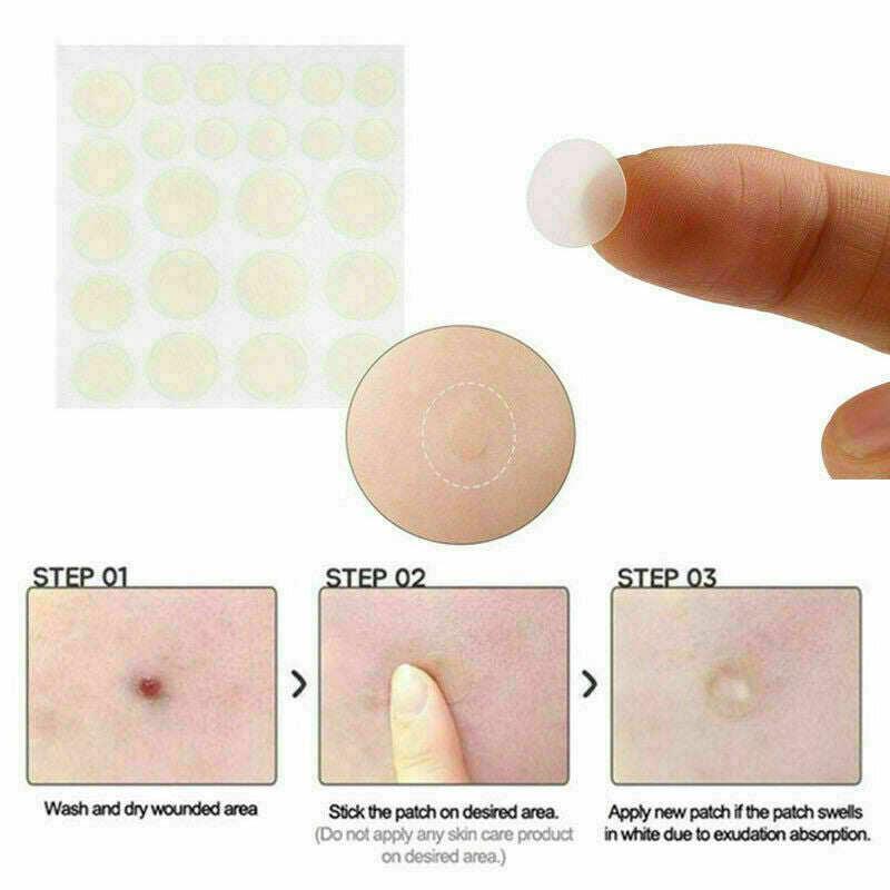 36 Patches Anti Acne Pimple Patch Face Skin Spot Scar Care Treatment Stickers ..