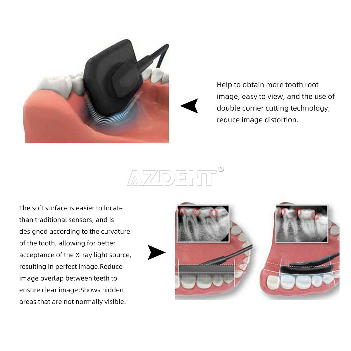Dental Digital X-Ray Sensor RVG Intraoral Imaging System For Dental&Pet Size:1.0