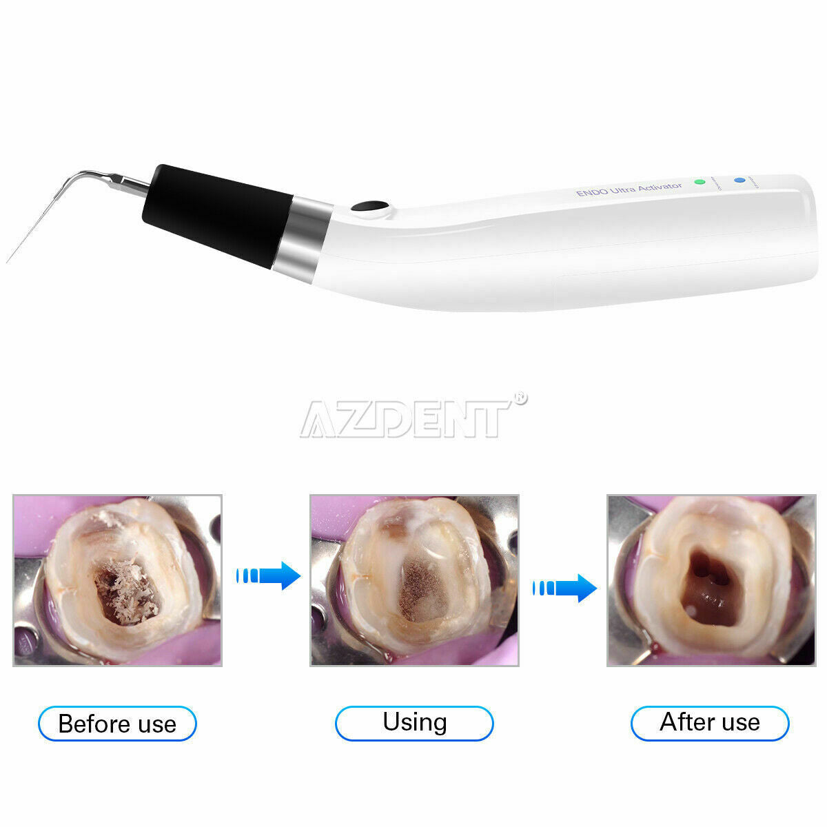 Dental Endo Ultra Activator Handpiece Sonic Endo Irrigator + 6pcs Titanium Tips