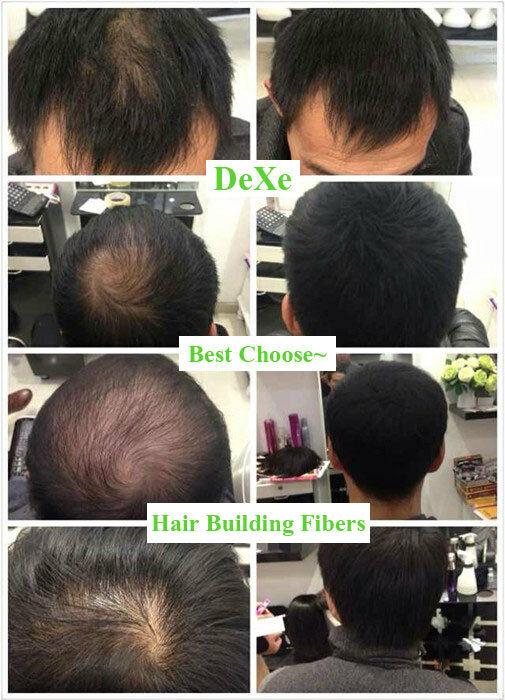 Black 22g DEXE Hair Building & Thickening Fiber For Hair Loss USA USPS SHIPPING