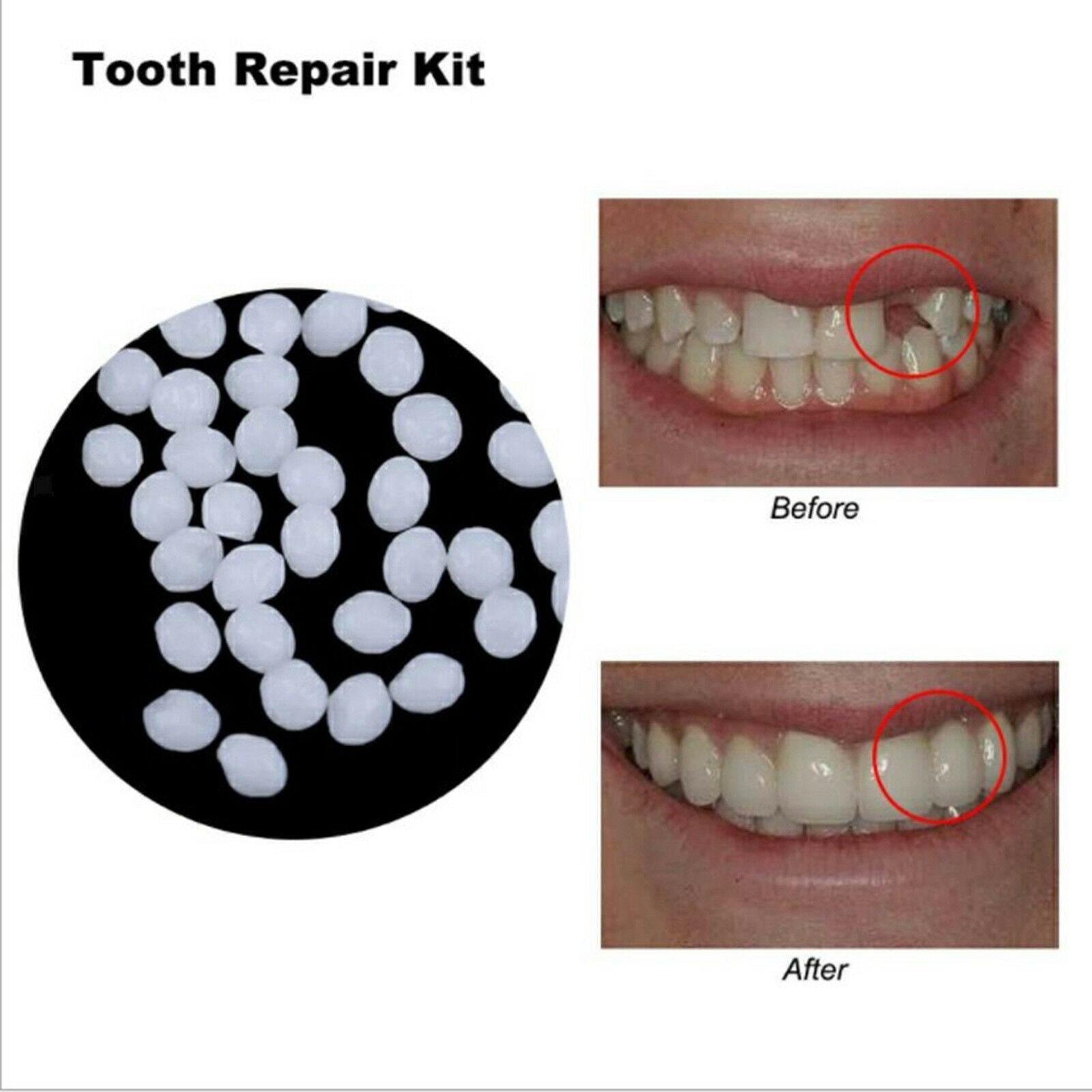 Thermal Tooth Filler Beads for Temporary Tooth Fix Missing Teeth or Brokens