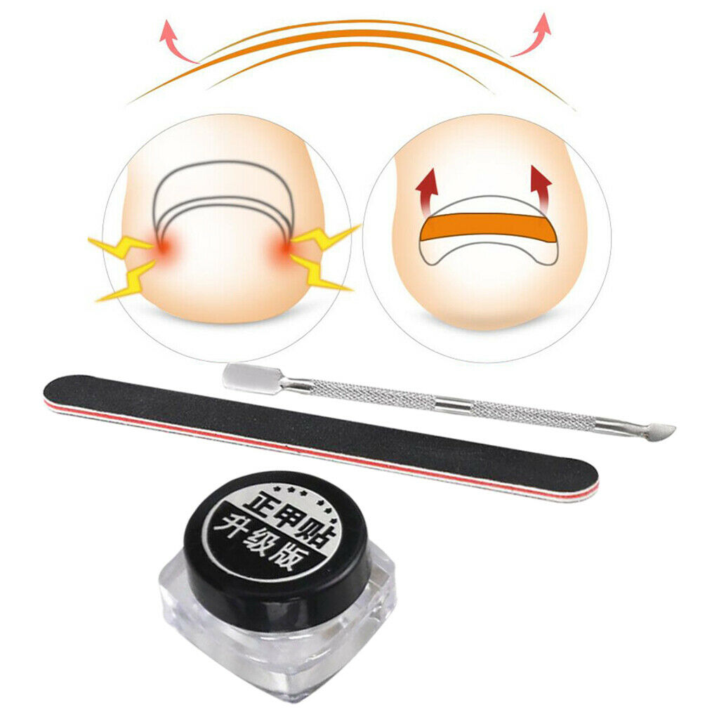 Ingrown Toenail Corrector Stickers Tape w/Pusher Nail File Set Pain Ease