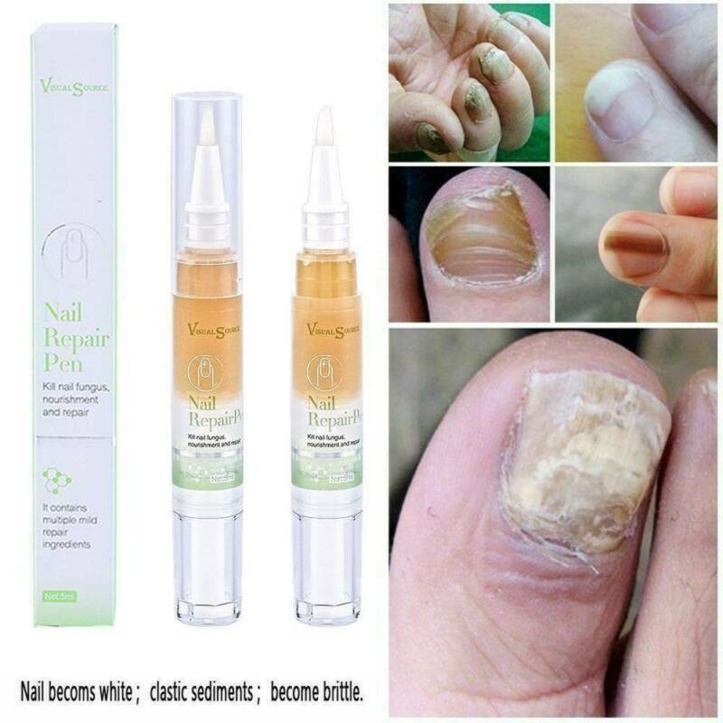 Anti Fungal Nail Treatment Finger Toe Care Nail Fungus Treatment Liquid Pen Hot