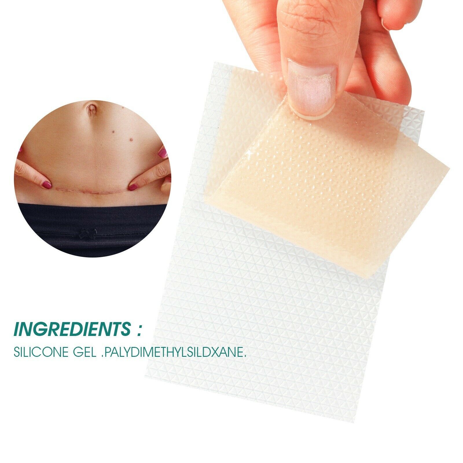 Silicone Gel Strips Patch Medical Reusable Scar Away Treatment Sheet Tape Repair
