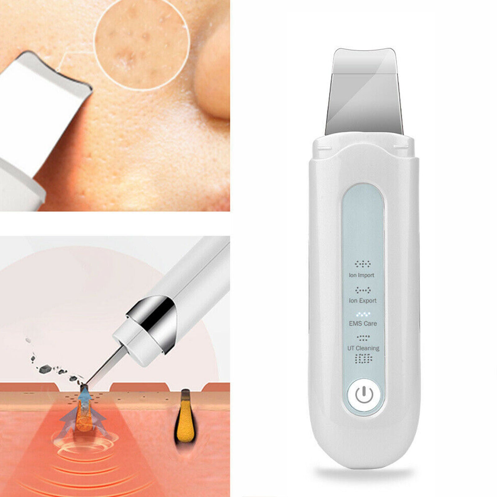 Facial Ultrasonic Skin Scrubber Spatula Face Extractor Peeling Deep Cleaner Tool