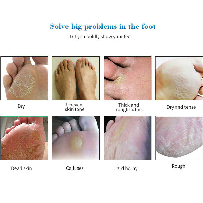 3 Pair Exfoliating Scrub Foot Care Peeling Sock Baby Soft Feet Removes Dead Skin
