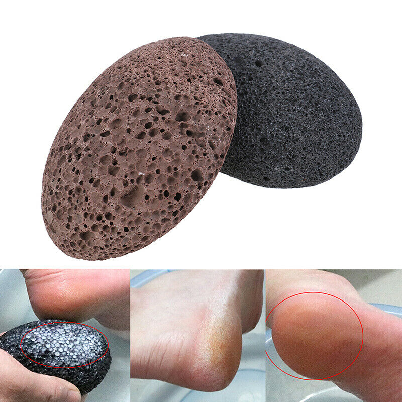 Foot Stone Exfoliating Lava Stone Grill Foot Massage Pumice Exfoliates Callu  XC
