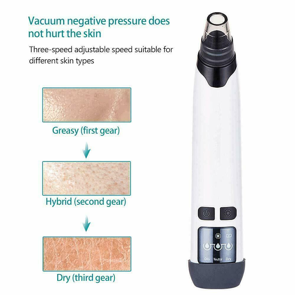 Electric Heating Blackhead Vacuum Pore Cleaner Acne Pimple Remover Suction Tool