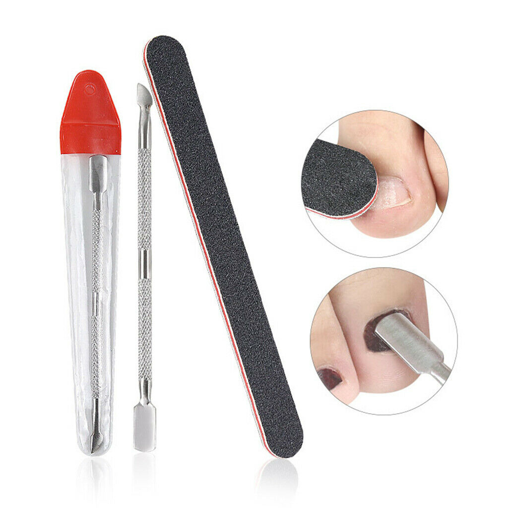 Strong Ingrown Toenail Set Supplies Tools for Nail Correction Men Women
